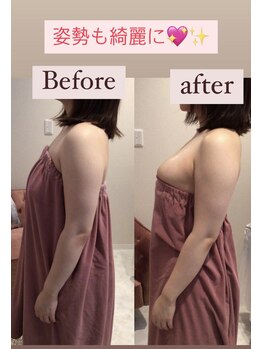 マイントゥー(mine too)/