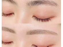 ベニー(Bennie)/ハリウッドブロウリフト