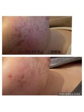 レヴェランジュ(Rebellange)/