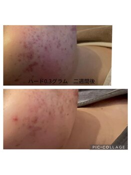 レヴェランジュ(Rebellange)/