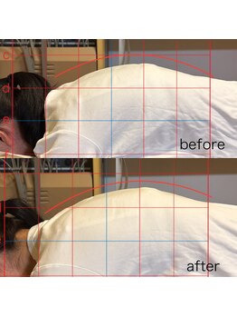 カイロプラクティック ネクサス/猫背とそり腰を撃退☆