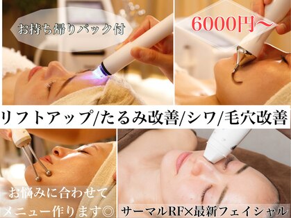 イヴ(Yves)の写真