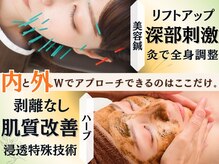 アネモネ 心斎橋院