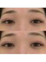 バニーアイズ 天神(Bunny eyes TENJIN)/フラット80本