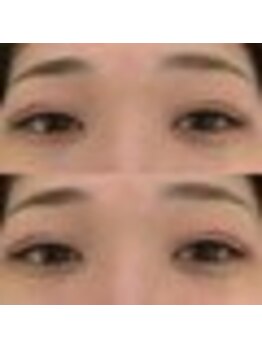 バニーアイズ 天神(Bunny eyes TENJIN)/フラット80本