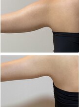 リアン 南熊本店(Lien)/韓国で話題！【マイクロ波】痩身