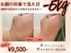 ソルニス(Solnis.)の写真