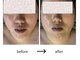 サロン リノ(salon rino)の写真