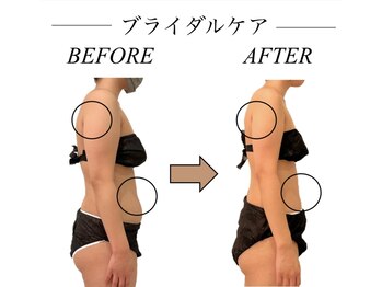 ファミーユ 新宿店/【ブライダル】ビフォーアフター