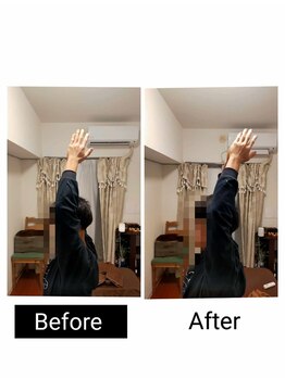 アース エンジェル整体院/ビフォアフ　肩こり　ストレッチ