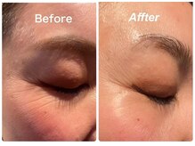 アールスタイルビューティ(R STYLE BEAUTY)/ビフォーアフター[フェイシャル]