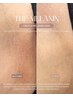 【股関節の黒ずみ改善◎】THE MELANIN★1ヶ月クリーム付き