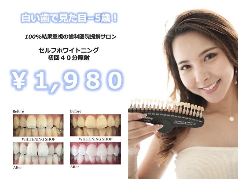 ＼\すぐ施術可能/／ホワイトニングセット シャインスマイル ホワイトニングキット Shine Smile Whitening Kit 歯