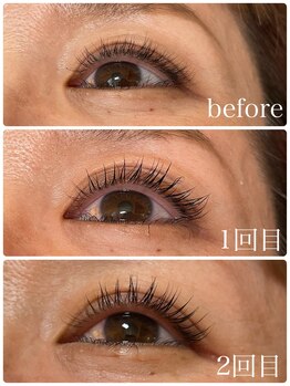 ラディユー(Radieux)/マイラミネーションお客様施術例