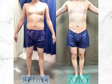 パラディ(PARADIS)/ハイパーナイフ/シェイプ/コルギ