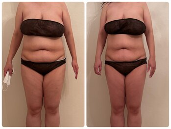 フランベル(Franc bell)/パイラソード【上半身モニター】