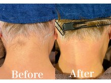 ジョエルワックス 沖縄那覇店(JOELLE WAX)/白い毛でも脱毛可能◯