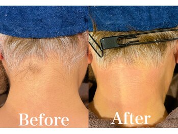 ジョエルワックス 沖縄那覇店(JOELLE WAX)/白い毛でも脱毛可能◯