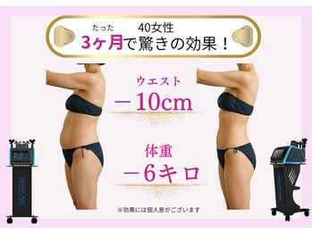 ベルフィーヌボーテ(BELFINE beaute)/痩身エステ90分