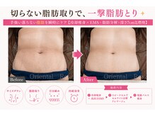 オリエンタルローザ 表参道(Oriental Rosa)/今すぐ引き締める！ならコレです