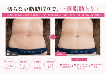 オリエンタルローザ 表参道(Oriental Rosa)/今すぐ引き締める！ならコレです