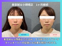 晴々