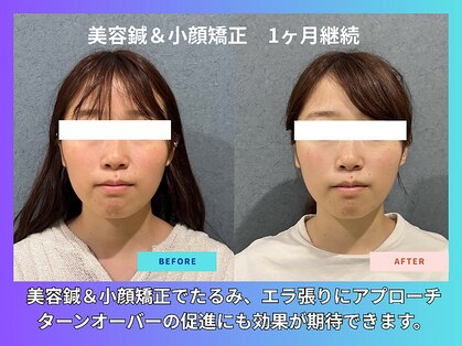 晴々の写真