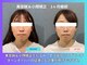 晴々の写真