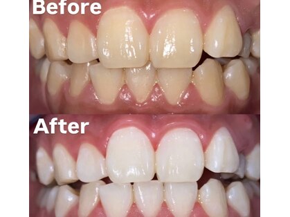 ホワイトニングビューティー 光の森店(WHITENING BEAUTY)の写真