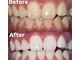ホワイトニングビューティー 光の森店(WHITENING BEAUTY)の写真