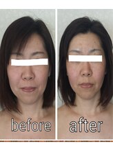 プライベートサロン 美月/立体的小顔へ