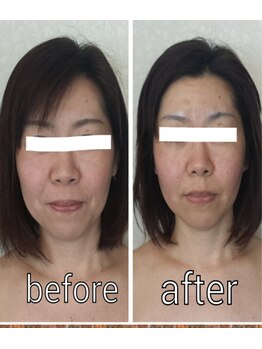 プライベートサロン 美月/立体的小顔へ