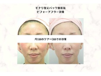 サロン ド マハロ(Salon de MAHALO)/お顔の血流アップ復元パック