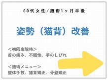 篠丸接骨院/◎施術実績◎姿勢（猫背）の改善
