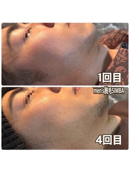 メンズ シンバ(SIMBA)/◯before→after◯