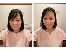 名古屋鍼灸 美容健康院/ビフォーアフター