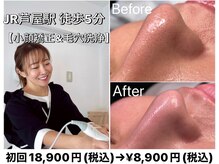 くすくす