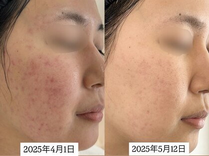 ピヌ(Pinu)の写真