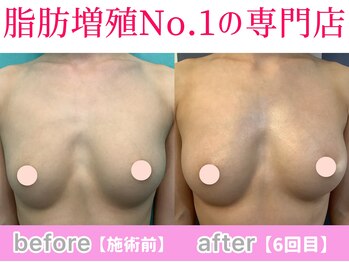 サラエクセレント 心斎橋(SARA EXCELLENT)/数回でもサイズアップ！育乳