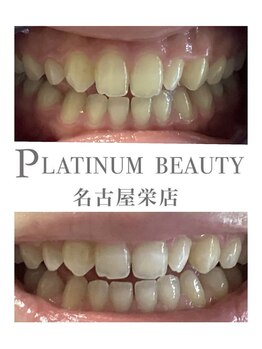 プラチナムビューティー 名古屋栄本店(PLATINUM BEAUTY)/お客様Before After