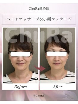 チュラ鍼灸院 西宮北口(ChuRa鍼灸院)/ヘッドスパ&小顔マッサージ