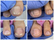 爪処 中野坂上/フットケア