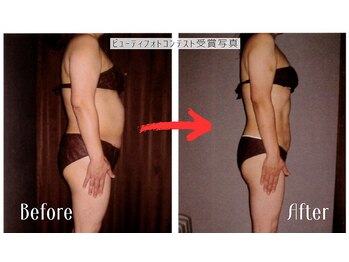 エンダモロジーサロン ココロミ(Cocolomi)/エンダモロジー結果写真４
