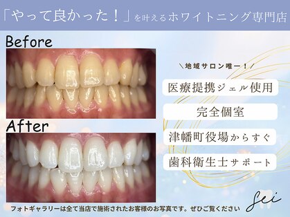 セイ(sei)の写真