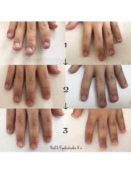 ネイルアンドアイラッシュ アヴィ(Nail and Eyelash A'vi)/自爪育成コース