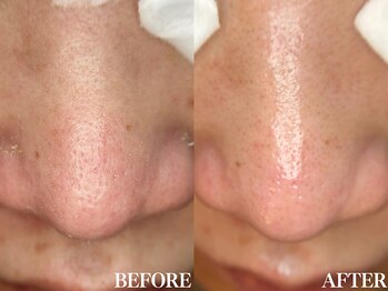 サロン ムスブ(salon MUSUBU)/山梨エステ/甲府エステ