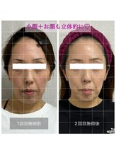 ファミーユ(famille)/小顔頭蓋骨骨盤矯正 B/A