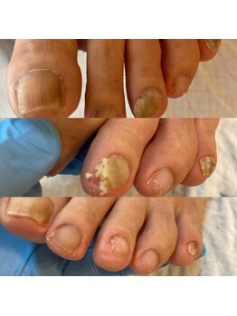 ララルアナ(Lara luana)/爪×フットケア