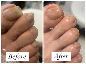 リゼラアンドコー 金沢店(LIZERA&Co)/足爪ケア