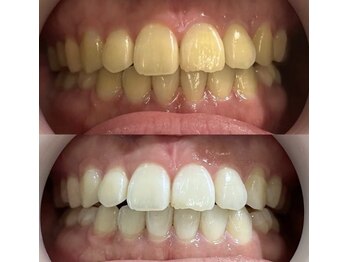 サロンエル(SALON el)/◇医療提携ホワイトニング◇